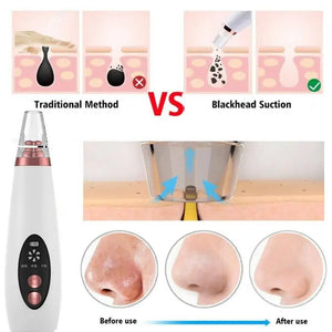 USB Rechargeable Blackhead Remover Vacuum