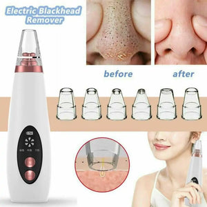 USB Rechargeable Blackhead Remover Vacuum